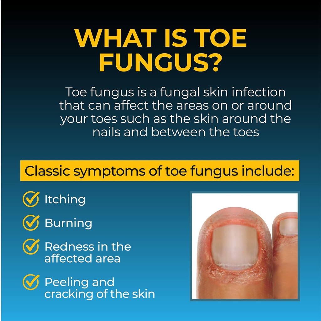 fungi-nail-anti-fungal-ointment-0-7-fl-o-5.jpg