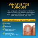 fungi-nail-anti-fungal-ointment-0-7-fl-o-5.jpg