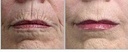 gaba-freeze-24-7-skin-tightening-firming-4.jpg