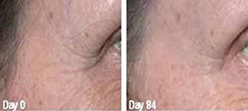 gaba-freeze-24-7-skin-tightening-firming-3.jpg