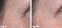 gaba-freeze-24-7-skin-tightening-firming-3.jpg