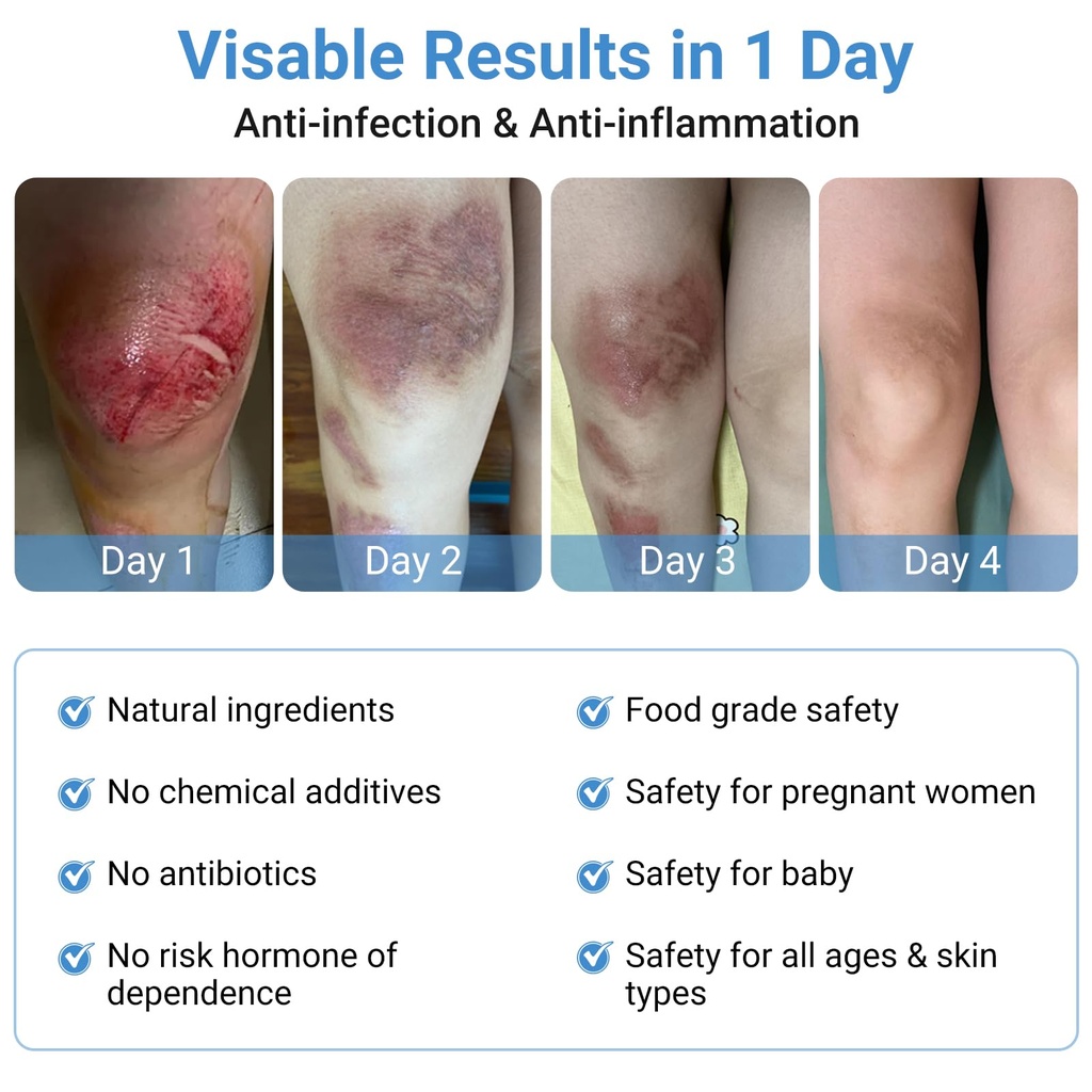 lmnoop-wound-care-ointment-fast-healing--3.jpg