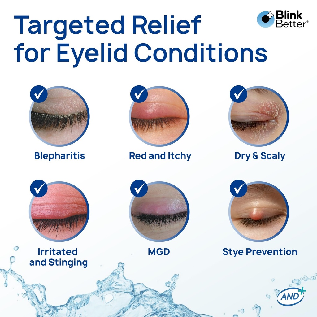 blinkbetter-betterlids-boosted-hypochlor-5.jpg