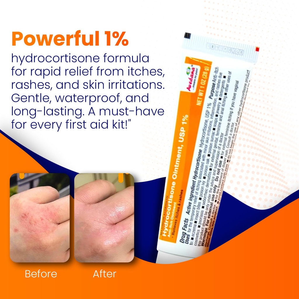 avedana-hydrocortisone-ointment-1-usp-ma-2.jpg