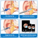 ear-wax-removal-ear-cleaner-ear-camera-f-4.jpg