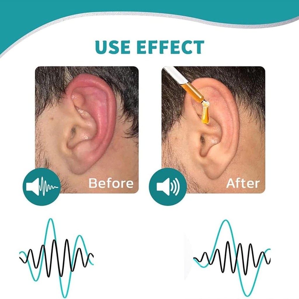 ear-care-drops-plant-formula-earwax-remo-3.jpg