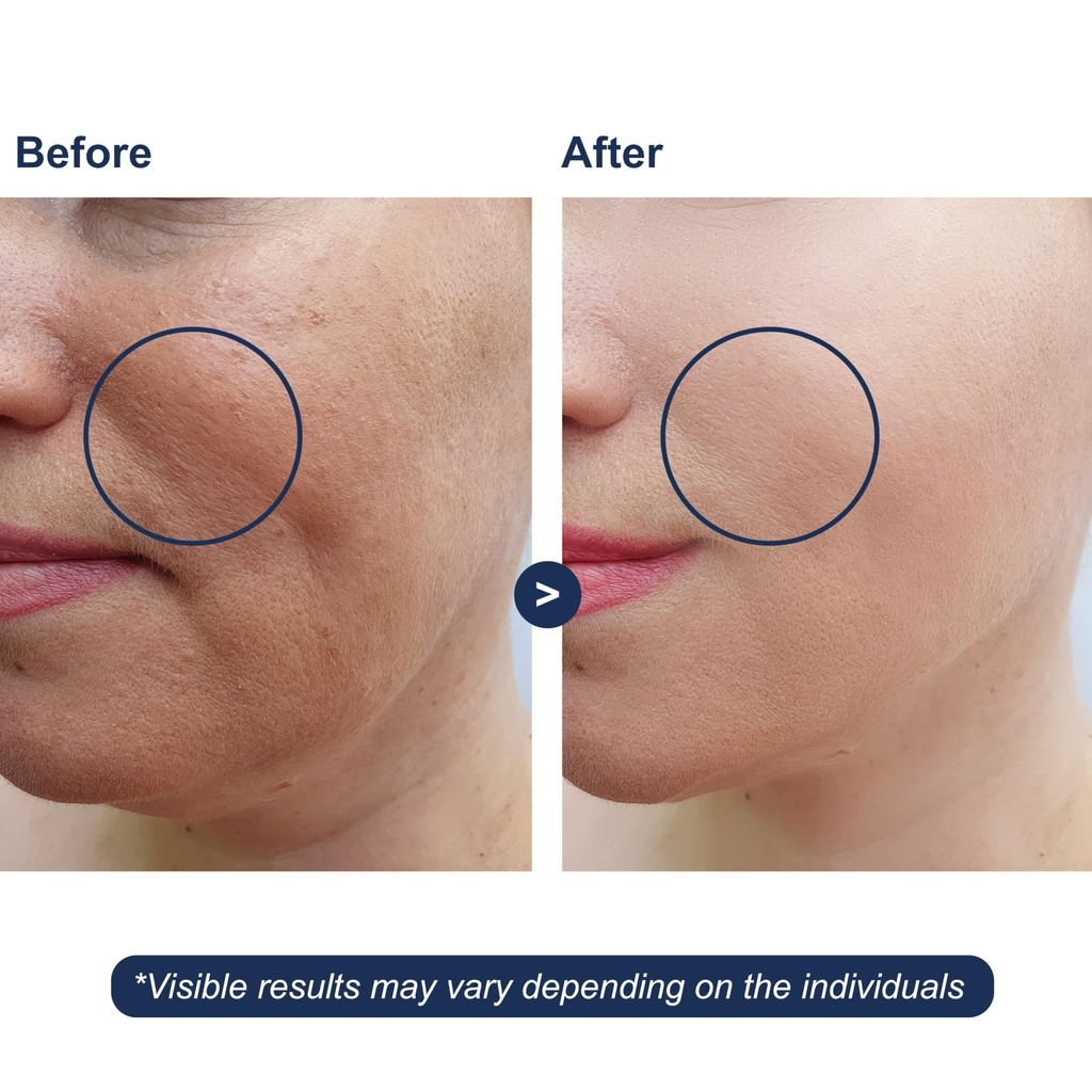 hyaluronic-acid-serum-with-vitamin-b5-fo-3.jpg