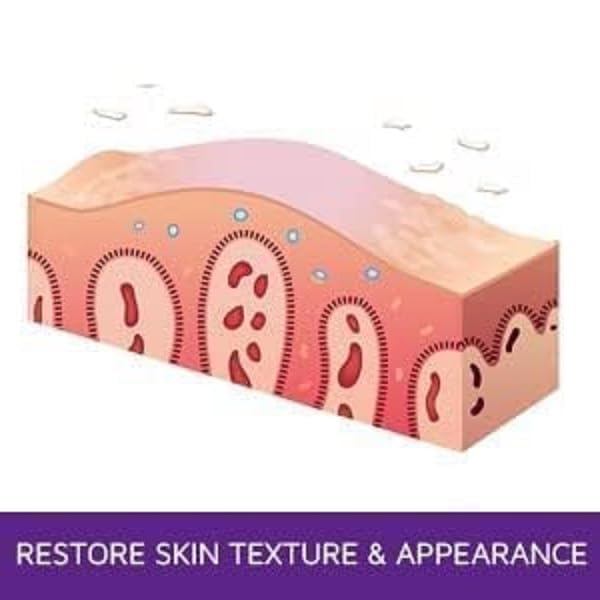prosoria-psoriasis-exfoliating-moisturiz-3.jpg