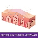 prosoria-psoriasis-exfoliating-moisturiz-3.jpg