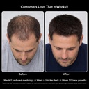 dht-blocker-for-men-with-biotin-10000mcg-5.jpg