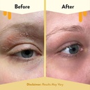 eczema-honey-multi-peptide-eye-cream-ant-4.jpg