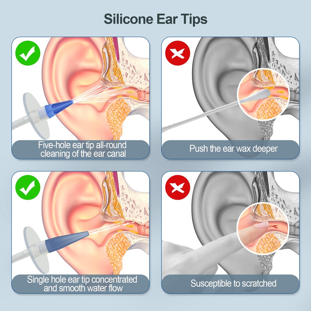 ear-wax-removal-kit-ear-cleaning-kits-ma-4.jpg