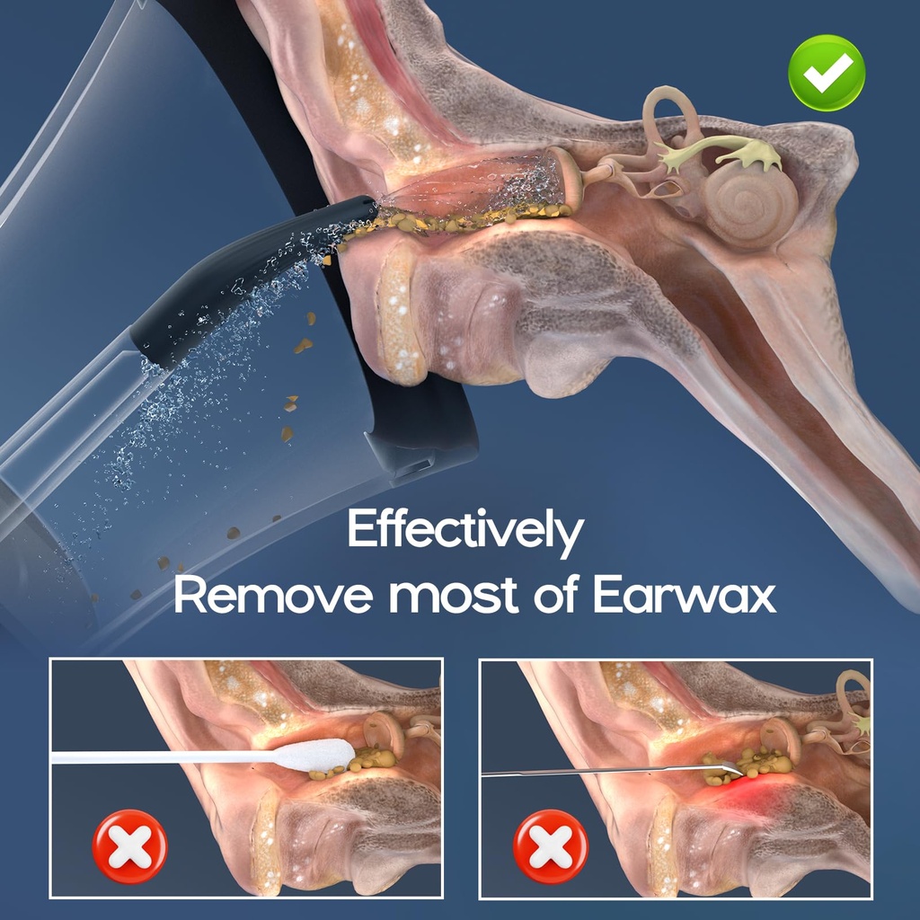 ear-wax-removal-electric-ear-cleaning-ki-2.jpg