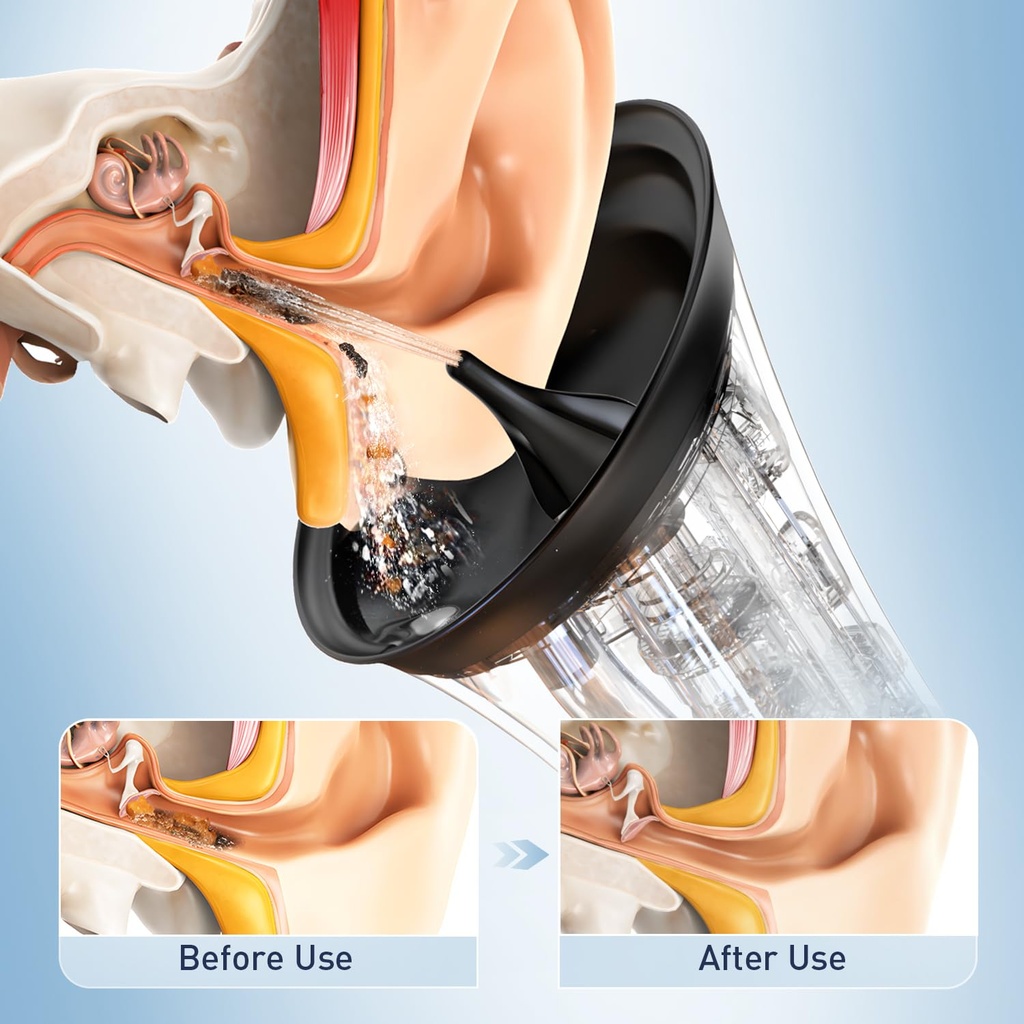 electric-ear-wax-removal-system-water-po-2.jpg