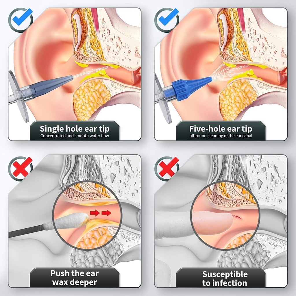 ear-wax-removal-ear-cleaner-ear-cleaning-4.jpg