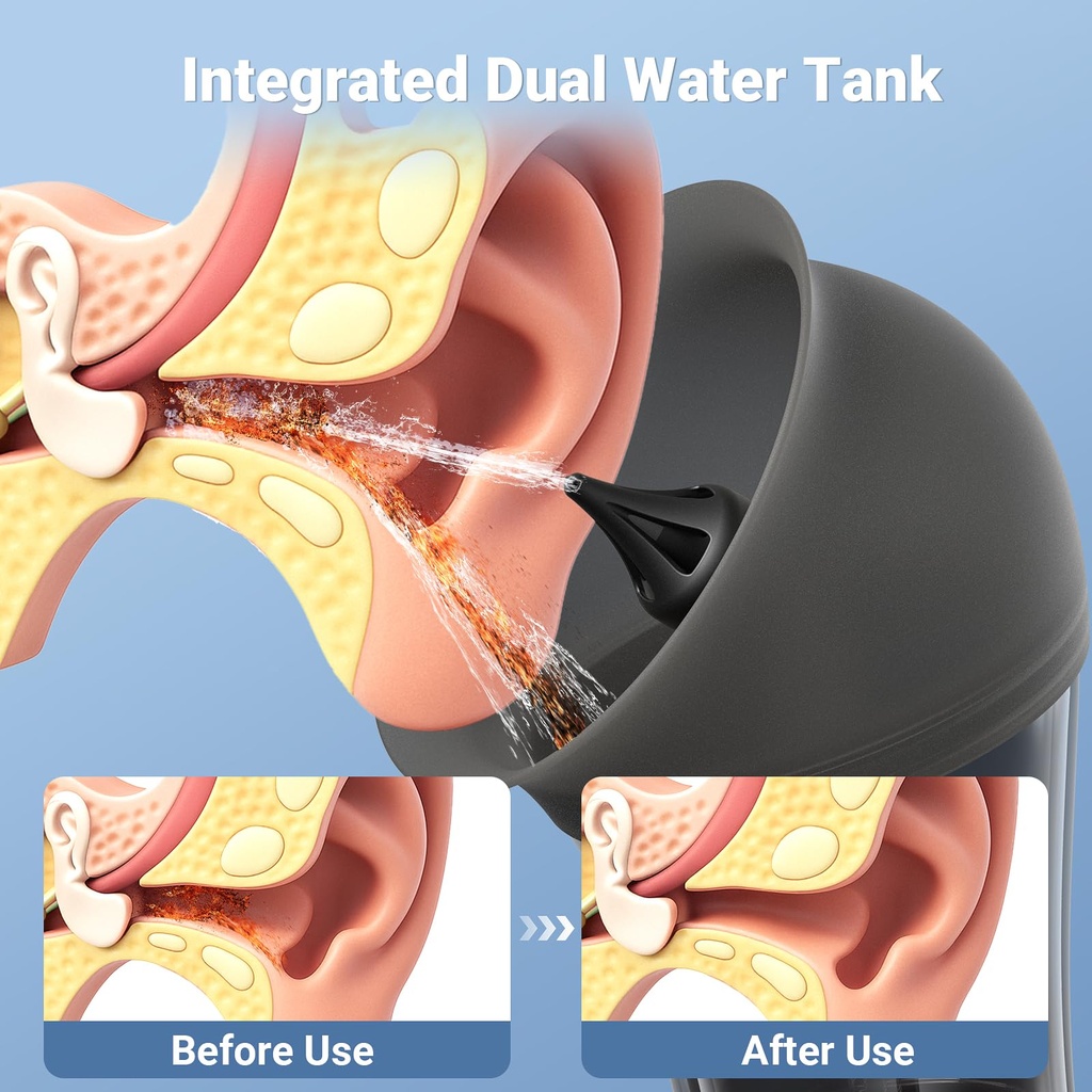 scopearound-electric-ear-cleaner-w-water-2.jpg