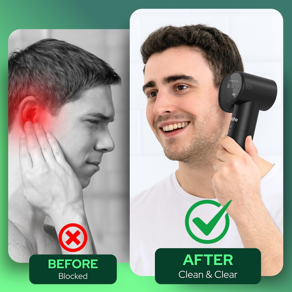 electric-ear-wax-removal-kit-for-adults--3.jpg