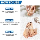toenail-fungus-treatment-extra-strength--6.jpg