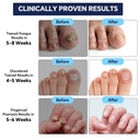 toenail-fungus-treatment-extra-strength--3.jpg
