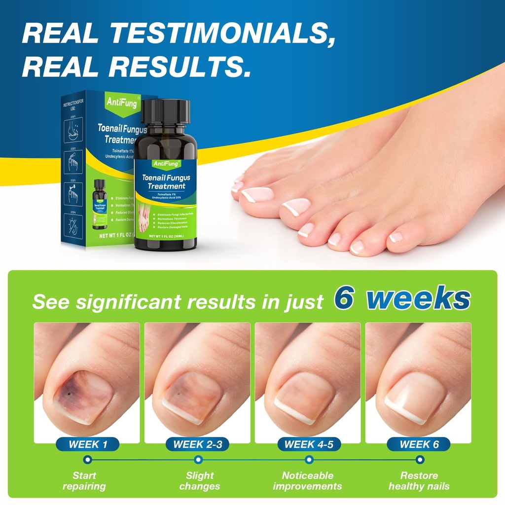 toenail-fungus-treatment-extra-strength--3.jpg