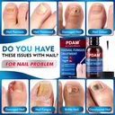toenail-fungus-treatment-extra-strength--2.jpg