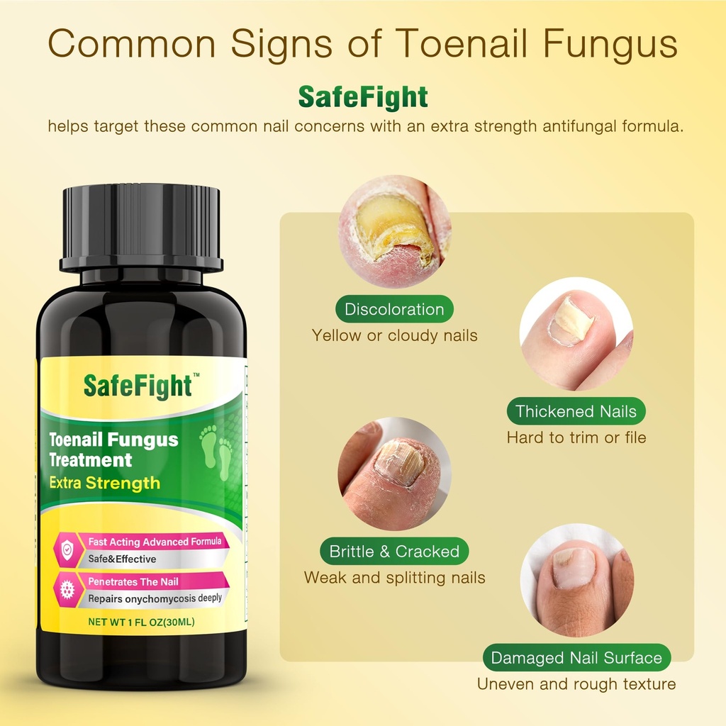 toenail-fungus-treatment-with-25-undecyl-3.jpg