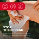 after-bite-ivy-relief-treatment-wipes-fa-3.jpg