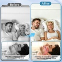 nasal-strips-for-snoring-30-count-black--4.jpg