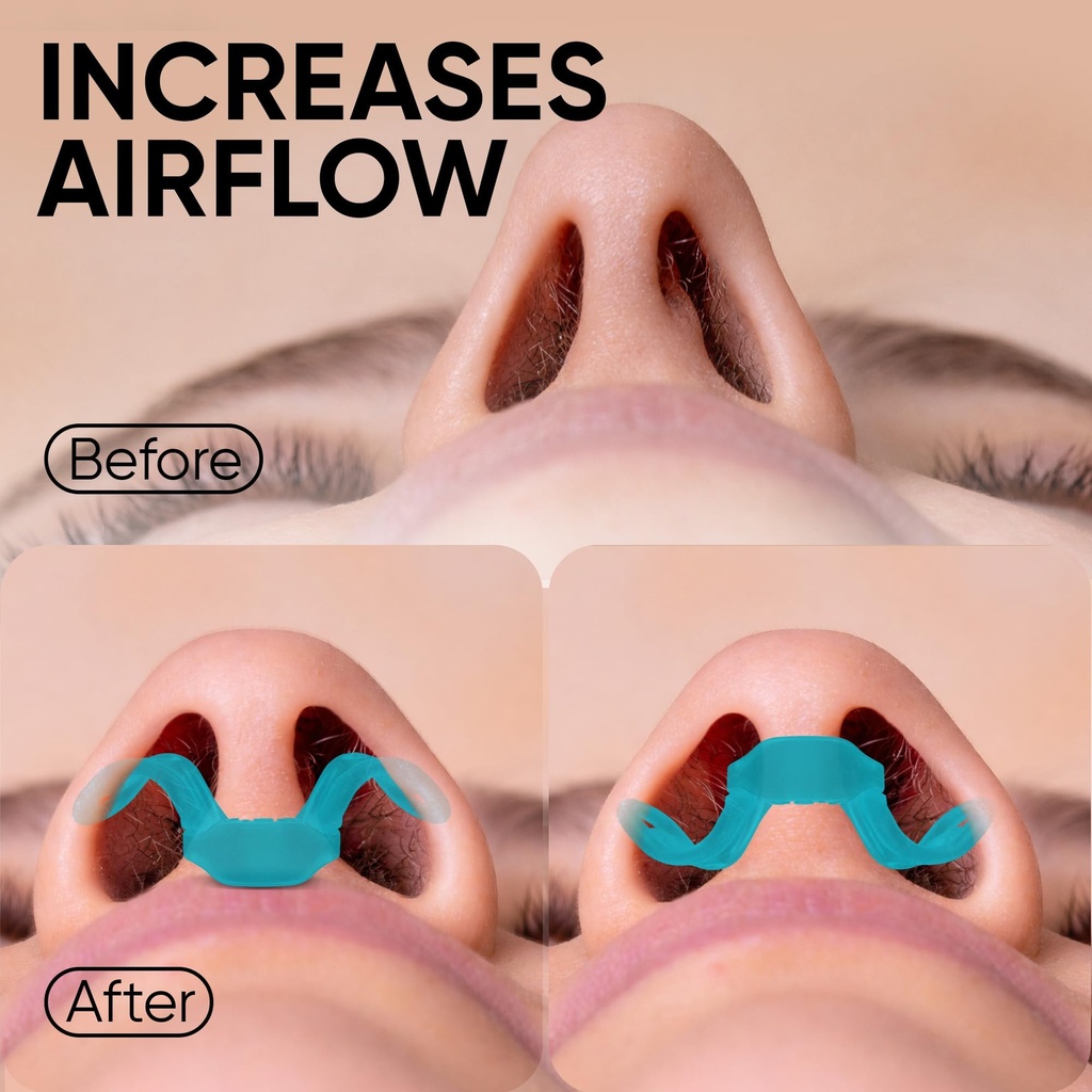 brison-nasal-dilators-for-breathing-and--4.jpg