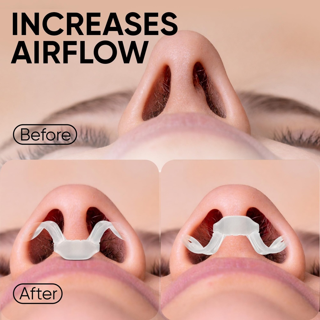 brison-nasal-dilators-for-snoring-better-4.jpg