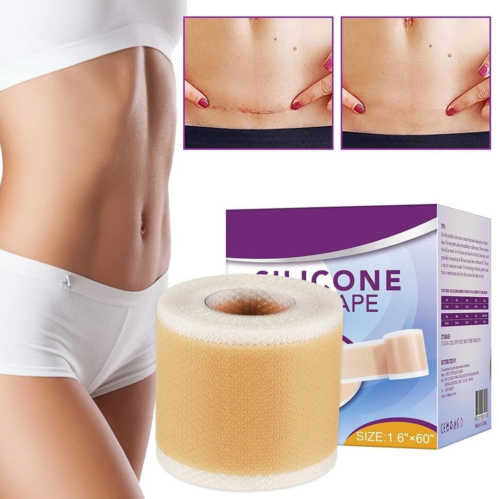 silicone-scar-tape-roll-1-6-x-60-medical-5.jpg
