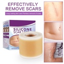 silicone-scar-tape-roll-1-6-x-60-medical-2.jpg
