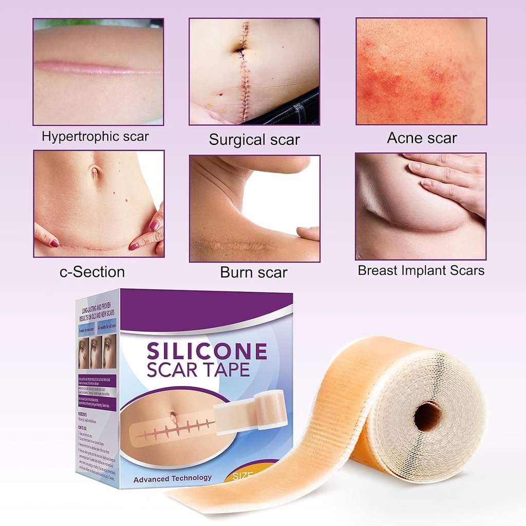 silicone-scar-tape-roll-1-6-x-60-medical-3.jpg