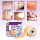 silicone-scar-tape-roll-1-6-x-60-medical-3.jpg