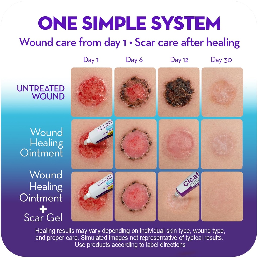 cicatricure-skin-recovery-kit-wound-scar-6.jpg