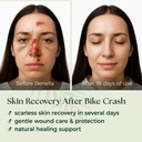 natural-wound-care-burn-gel-first-aid-ge-5.jpg