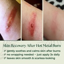 natural-wound-care-burn-gel-first-aid-ge-6.jpg