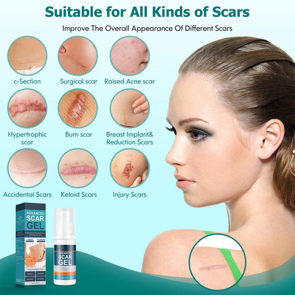 gowgaw-scar-gel-scar-cream-advance-scar--3.jpg
