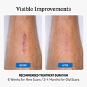 nuvadermis-silicone-scar-sheets-extra-lo-5.jpg