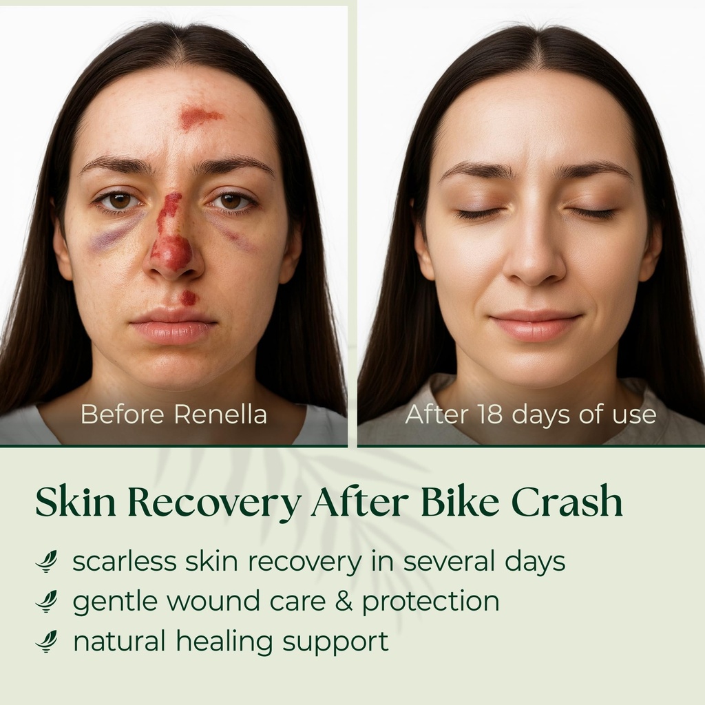 scarless-skin-recovery-natural-first-aid-5.jpg