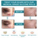 medical-grade-silicone-scar-sheets-silic-3.jpg