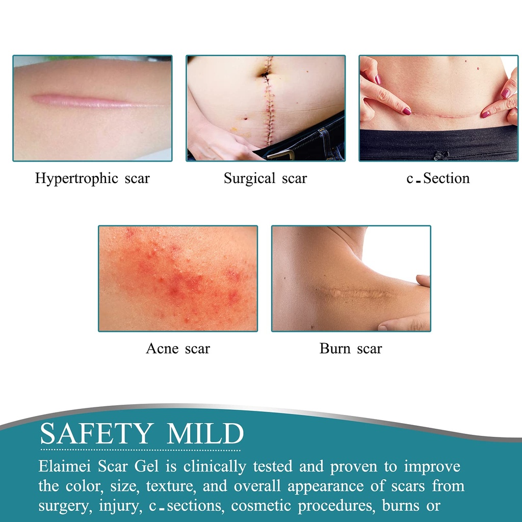 medical-grade-silicone-scar-sheets-silic-4.jpg