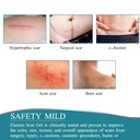 medical-grade-silicone-scar-sheets-silic-4.jpg