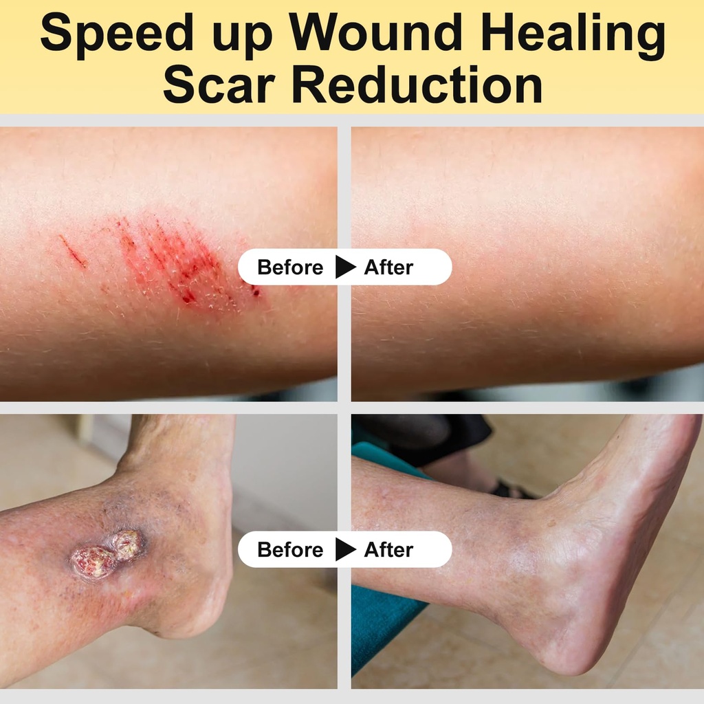 manuka-honey-for-wounds-speed-up-healing-5.jpg