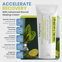calendula-burn-cream-healing-ointment-fo-2.jpg