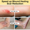 manuka-honey-for-wounds-great-for-cuts-s-5.jpg
