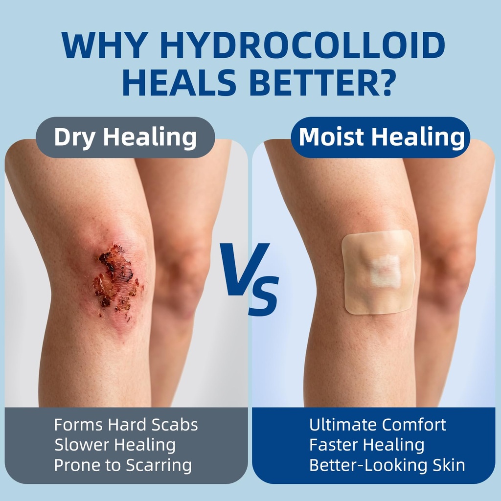 niceful-hydrocolloid-bandages-2-x2-20-co-4.jpg
