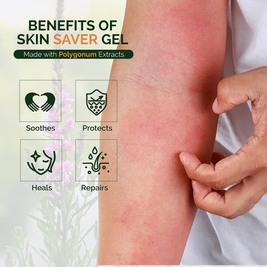 moraz-skin-saver-herbal-healing-scar-gel-3.jpg