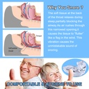 anti-snoring-device-stop-snoring-comfort-4.jpg