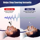 anti-snore-mouth-guard-anti-snoring-mout-2.jpg